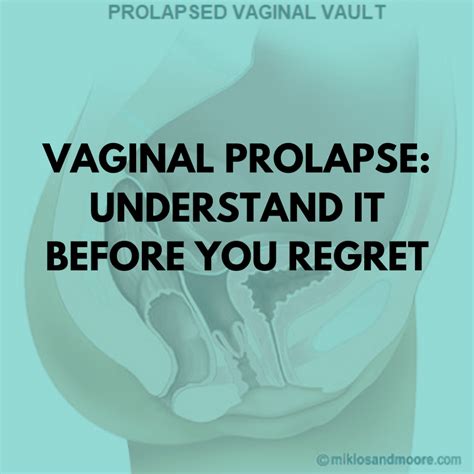 cervix prolapse porn|Free Cervix Prolapse Porn Videos .